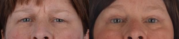 A happy customer of Glazer Facial Plastic & Cosmetic Surgery